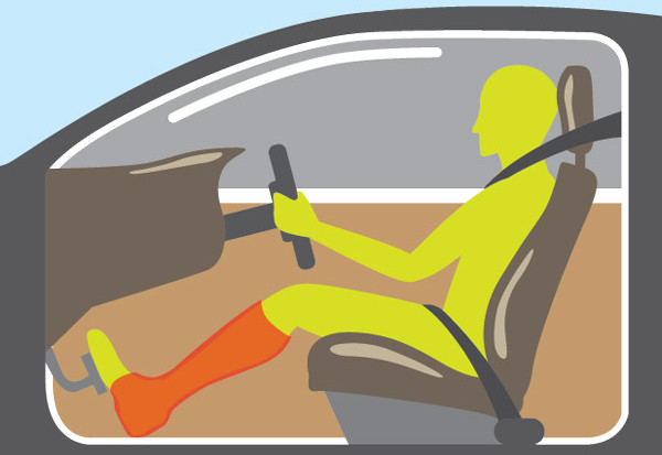 image of driver with leg in a cast